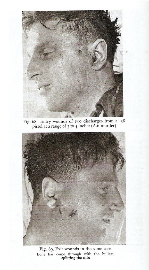 Click image for larger version

Name:	Mike Gregsten's autopsy photos 2.jpg
Views:	1389
Size:	207.0 KB
ID:	706856