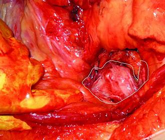 Click image for larger version

Name:	Picture 8 Uterus.jpg
Views:	445
Size:	119.6 KB
ID:	712583