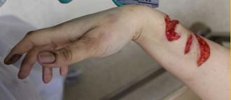 Click image for larger version

Name:	Defensive Wound.JPG
Views:	562
Size:	13.3 KB
ID:	735906