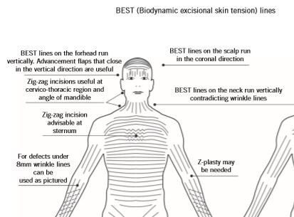 Click image for larger version

Name:	Sternum Incisions.JPG
Views:	414
Size:	33.0 KB
ID:	736838