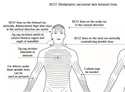 Click image for larger version

Name:	Sternum Incisions.JPG
Views:	434
Size:	33.0 KB
ID:	736838