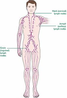 Click image for larger version

Name:	Cancer nodes.jpg
Views:	526
Size:	70.0 KB
ID:	741612