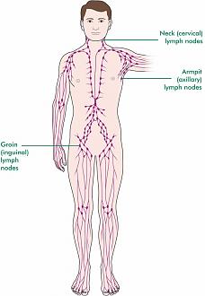 Click image for larger version

Name:	Cancer nodes.jpg
Views:	453
Size:	70.0 KB
ID:	741612