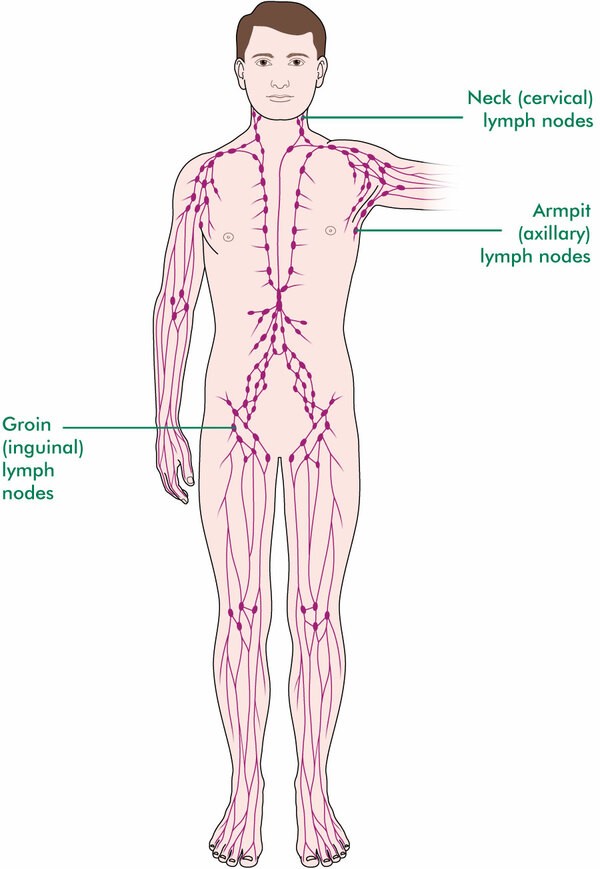 Click image for larger version  Name:	Cancer nodes.jpg Views:	0 Size:	70.0 KB ID:	747045