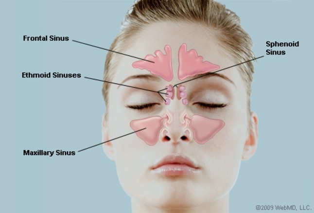 Click image for larger version  Name:	SINUS2.jpg Views:	0 Size:	36.1 KB ID:	747044