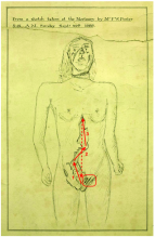 Click image for larger version

Name:	Analysis-of-wounds-inflicted-on-Catherine-Eddowes-From-a-sketch-by-Frederick-William.png
Views:	164
Size:	54.3 KB
ID:	780589