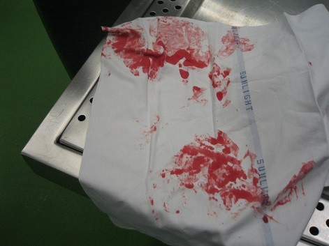Click image for larger version

Name:	wipe hands on cloth.jpg
Views:	230
Size:	39.9 KB
ID:	785976