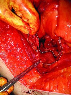 Click image for larger version  Name:	Picture 7 Uterus and fallopian tubes.jpg Views:	0 Size:	120.8 KB ID:	854163