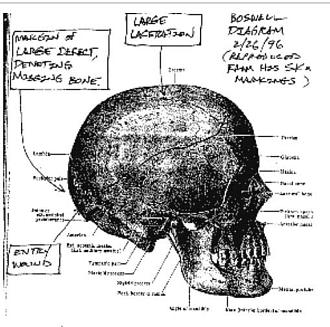 Click image for larger version

Name:	Skull-6.jpg
Views:	275
Size:	74.0 KB
ID:	805390