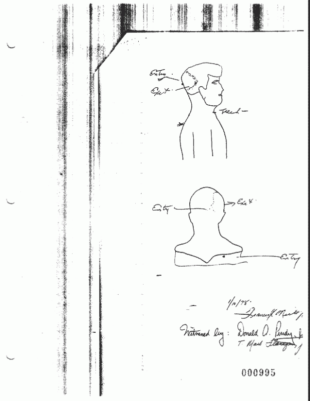 Click image for larger version

Name:	O'NEILL AUTOPSY PIC.gif
Views:	201
Size:	56.0 KB
ID:	805516