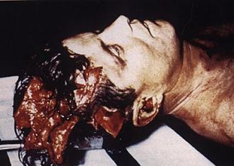 Click image for larger version  Name:	JFK_autopsy.jpg Views:	6 Size:	33.4 KB ID:	805677