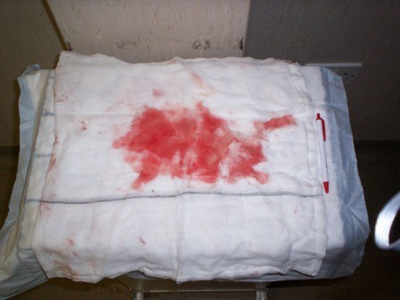 Click image for larger version

Name:	Normal Uterus.jpg
Views:	307
Size:	32.1 KB
ID:	806489