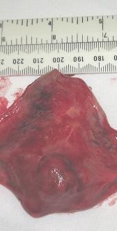 Click image for larger version

Name:	Uterus without fallopian tubes.jpg
Views:	307
Size:	131.7 KB
ID:	806716