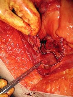 Click image for larger version

Name:	Uterus 3A.jpg
Views:	336
Size:	44.9 KB
ID:	813759