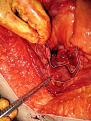Uterus 3A.jpg