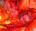 Picture 8 Uterus.jpg